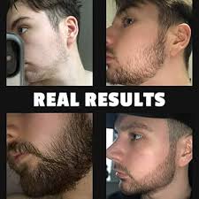 Derma Roller 540 Titanium Needle (0.5mm) Facial & Hair Therapy Microneedle Hair Regrowth Beard Growth Anti Hair Loss Treatment Thinning